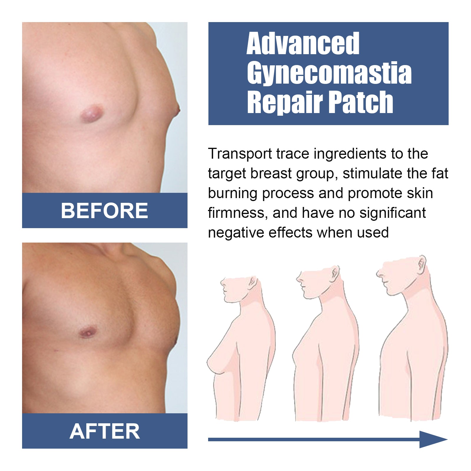 East moon Male Breast Firming Patch Men's Chest Skin Firming Anti-Sagging Chest Muscle Care Patch