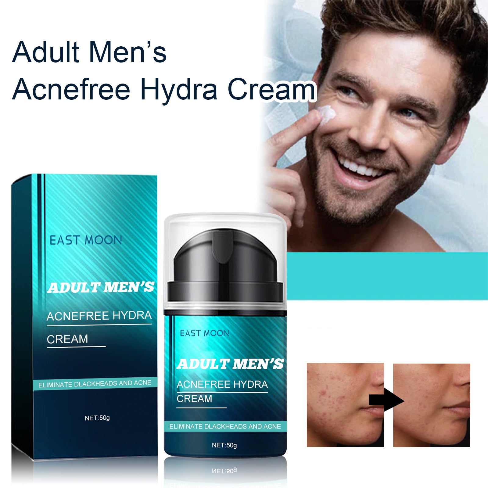 East Moon Men’s Face Cream – Anti-Wrinkle & Acne Scar Repair Moisturizer