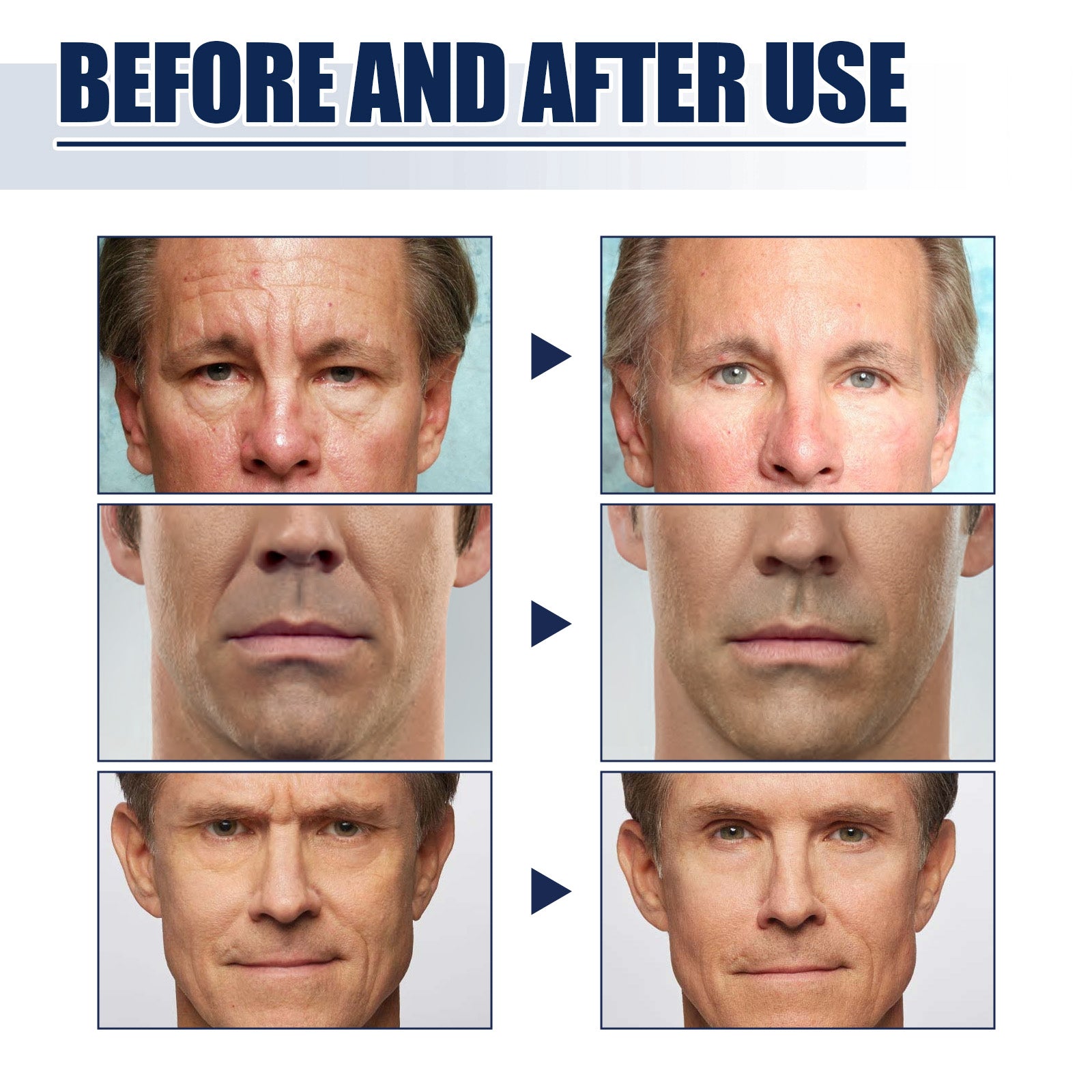 East Moon Men’s Face Firming Kit | Reduce Fine Lines & Wrinkles | Lift, Tighten & Brighten Skin
