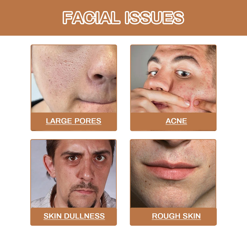 East Moon Men’s Facial Cleanser – Deep Cleansing & Oil Control Wash