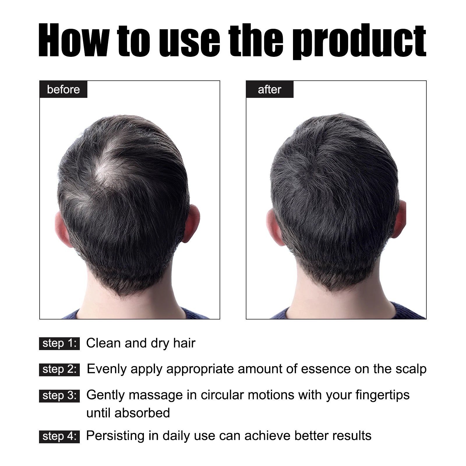 East Moon Men’s Hair Growth Serum