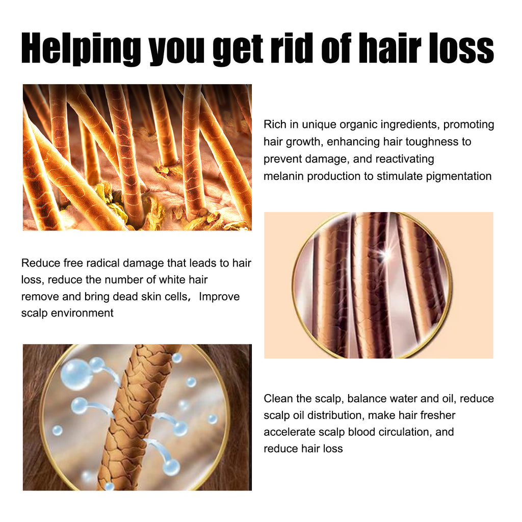 East Moon Men’s Hair Growth Serum