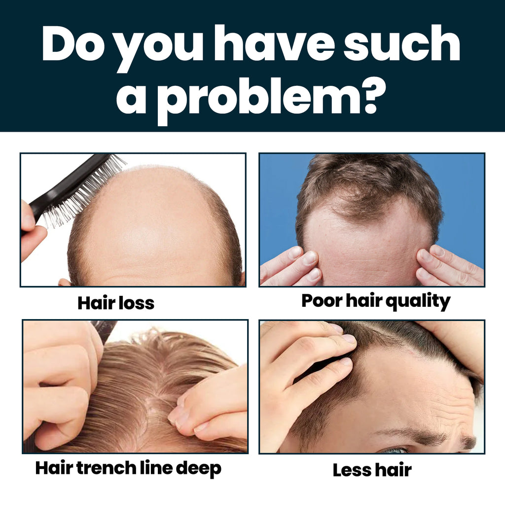 East Moon Men’s Hair Growth Serum – Nourishing & Revitalizing Essence