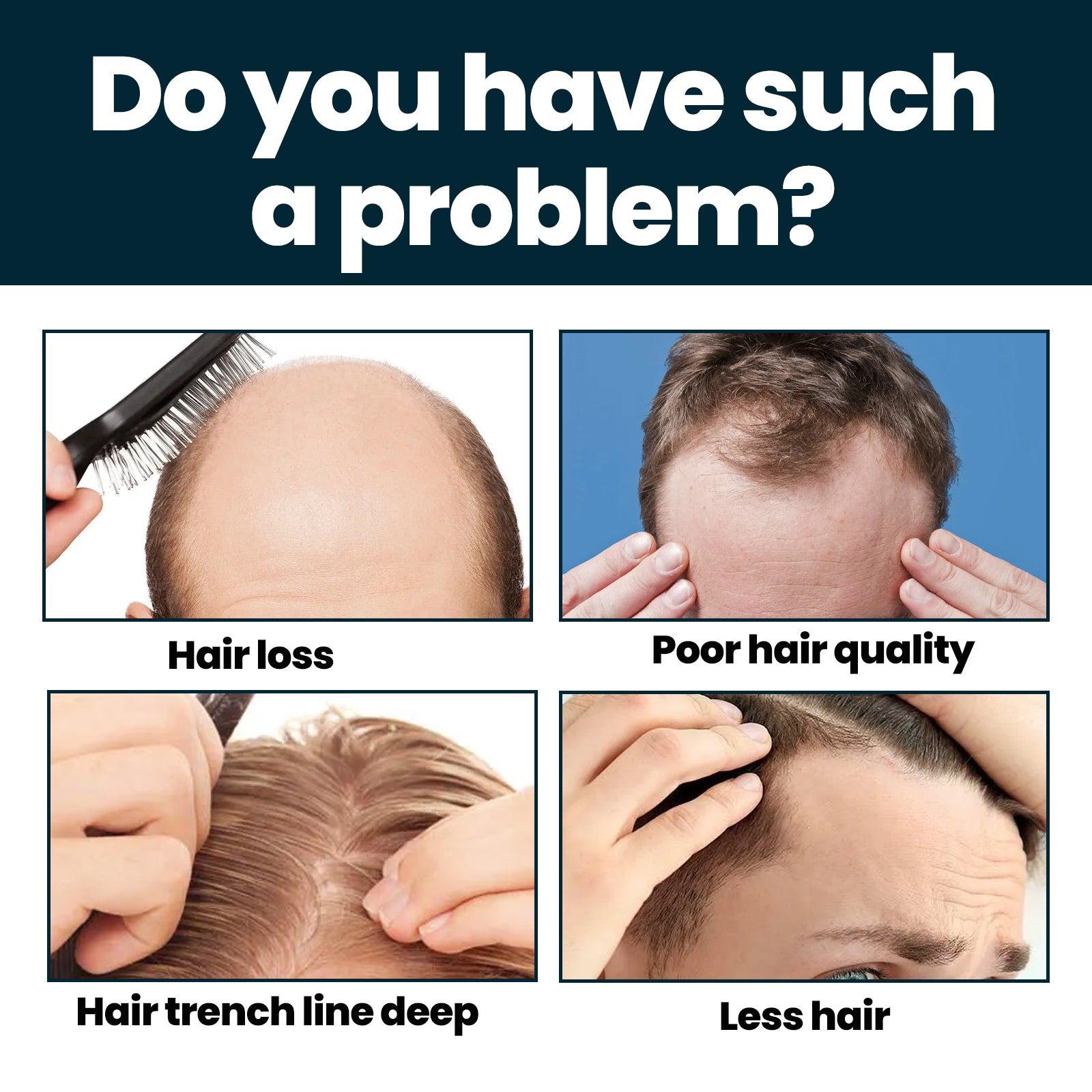 East Moon Men’s Hair Growth Serum – Nourishing & Revitalizing Essence