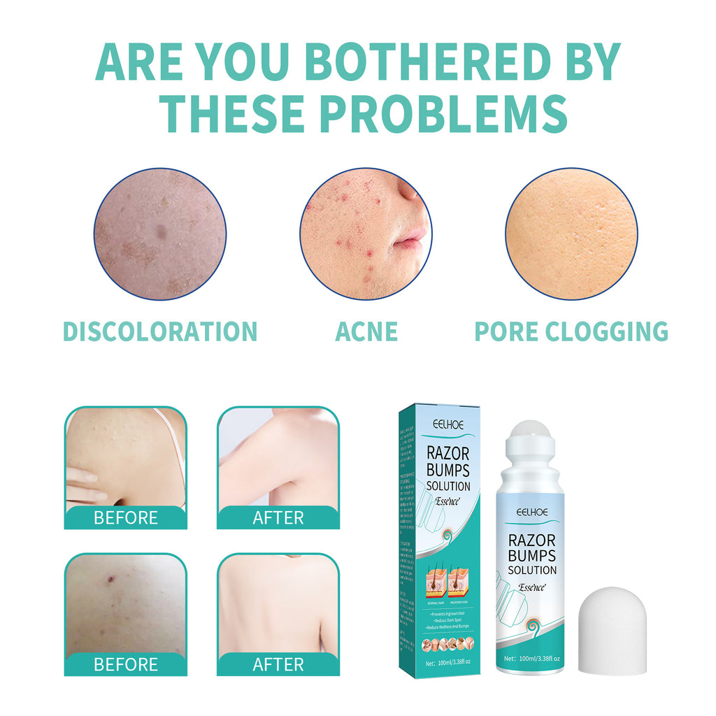 EELHOE Men’s Razor Bump Roll-On