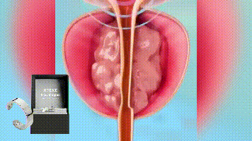 Hoexe silver Magnetic Ring Body Comfortable Sports Portable Simple Men's Daily Accessory Ring